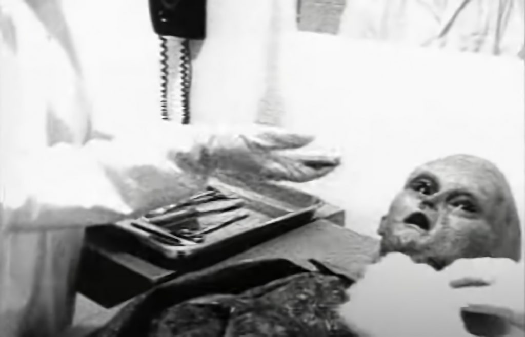 El extraterrestre de la película de la autopsia de Ray Santilli, en el quirófano.