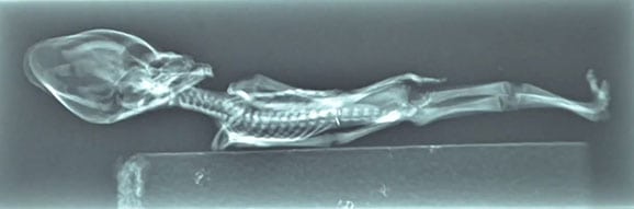Radiografia del cuerpo del 'extraterrestre de Atacama'.