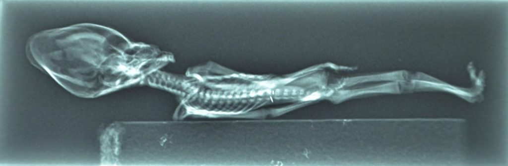 Radiografia del cuerpo del 'extraterrestre de Atacama'.