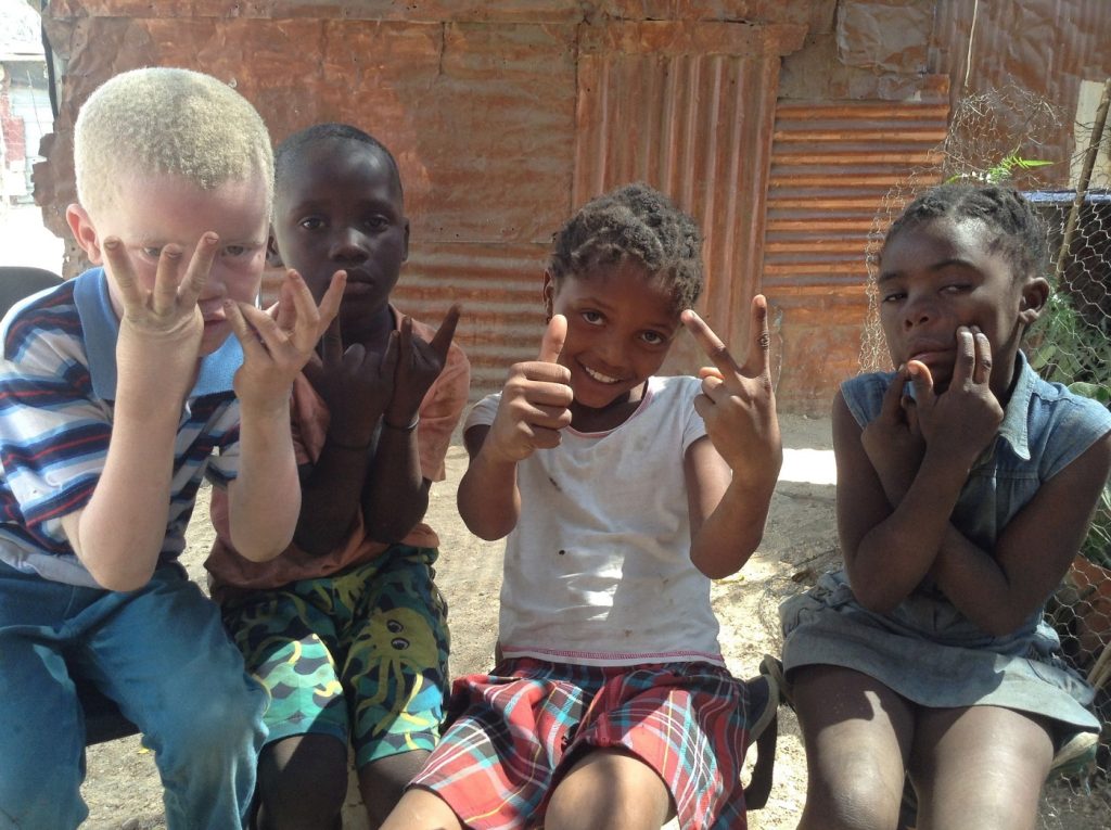 Un niño africano albino con sus amigos. Foto: Toon Sanders.